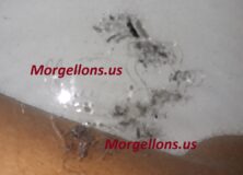 Cats Dogs Human and Aspergillus Fumigatus – Morgellons Disease the silent Pandemic