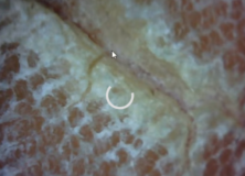Skin Pealing? – How to treat!! – Morgellons Disease: The Silent Pandemic Aspergillus Fumigatus