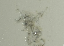 Skin Disease and Undecylenic acid – Morgellons Disease The Silent Pandemic Aspergillus Fumigatus